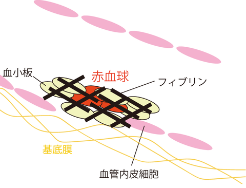 二次止血