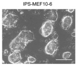 iPS