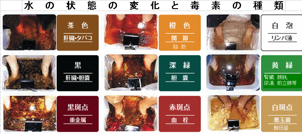 デトックスフットバスのお湯の色 神戸東灘岡本エステサロンリラクゼーションゆずのゲルマ温浴でダイエット 体質改善ブログ