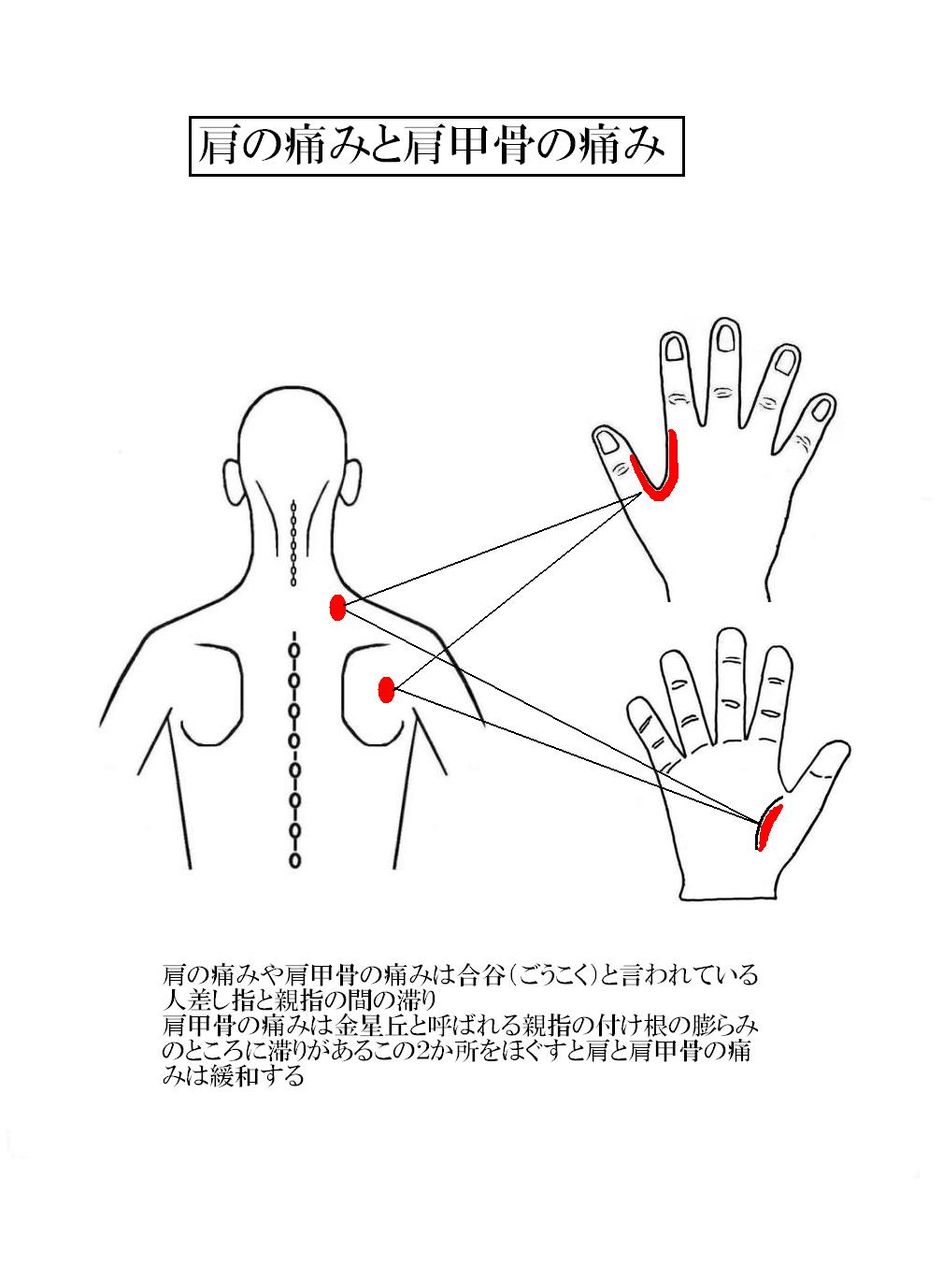 肩 甲骨 痛み