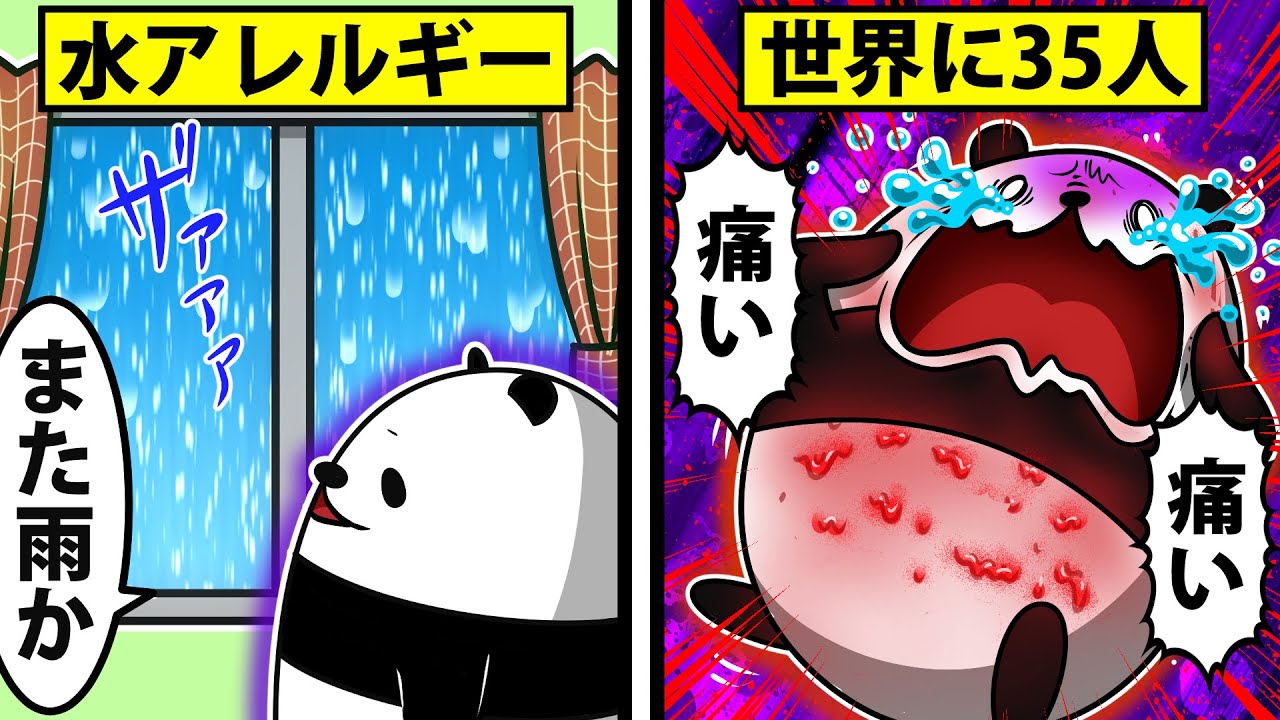 【気になる⁉】水アレルギーだけど聞きたいことある？