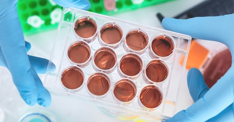 Atlantis-Bioscience-Blog-Cover-1522024-13