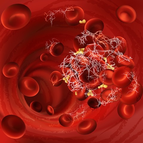 What-Are-Fibrinolytic-Enzymes