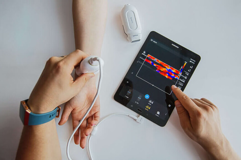 philips-lumify-portable-ultrasound