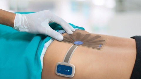 wound management devices