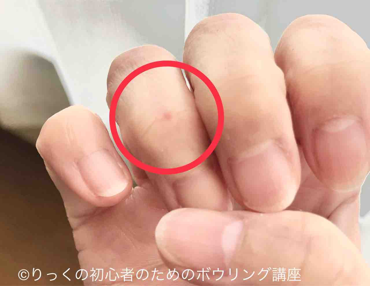 どこか傷めると ボウリングできるのか と思う りっくの初心者のためのボウリング講座