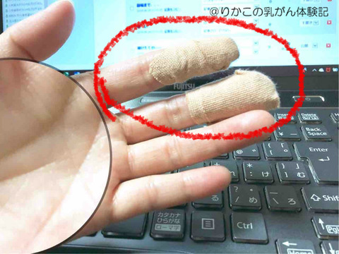 2018/06/30 怪我