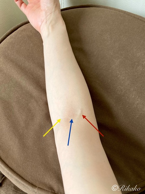 2023/09/28　採　血