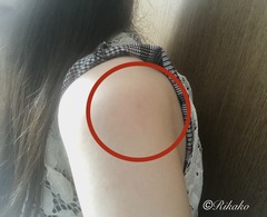 2021/08/27　ワクチン副反応まとめ　②