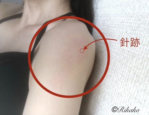 2021/08/27　ワクチン接種3日目の朝