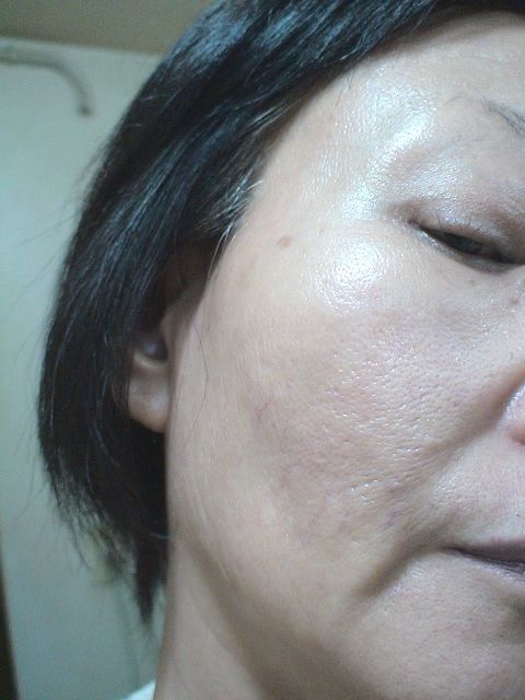 黒龍堂 薬効クリーム 黒龍 無香料 体験レポート 1 いつまでも若くありたい 黒龍堂 薬効クリーム 黒龍 無香料 体験レポート 1 いつまでも若くありたい