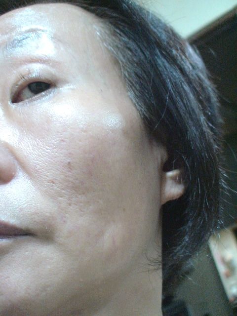 黒龍堂 薬効クリーム 黒龍 無香料 体験レポート 1 いつまでも若くありたい 黒龍堂 薬効クリーム 黒龍 無香料 体験レポート 1 いつまでも若くありたい