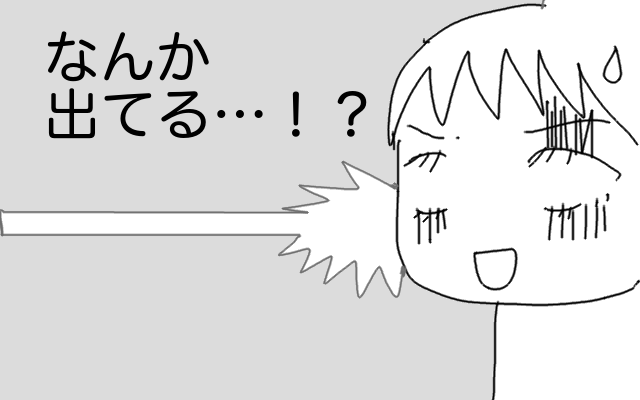 子宮脱 Uterine Prolapse Japaneseclass Jp