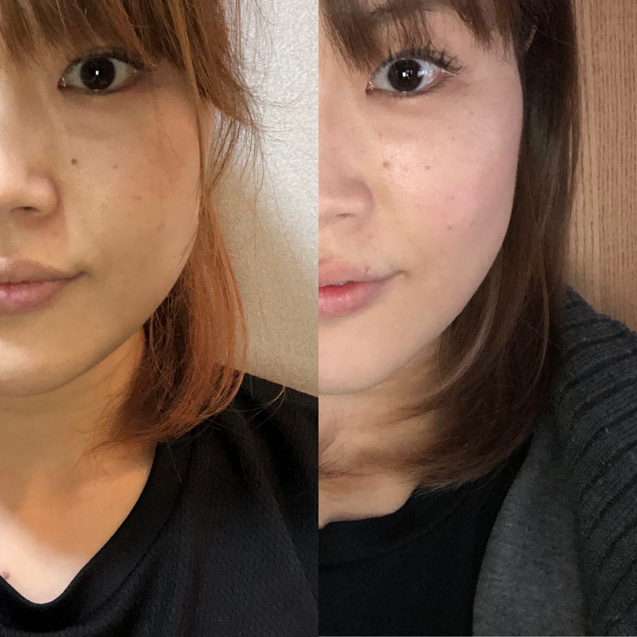 輪郭スッキリ クリニカルサロン Rin 凛