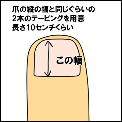 tume9