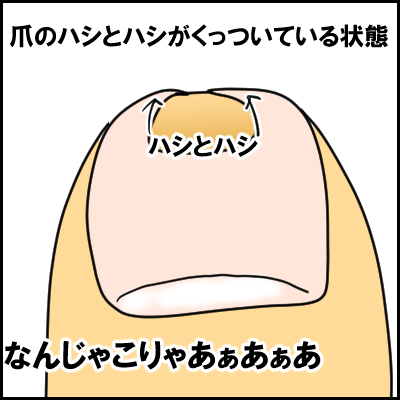 tume1