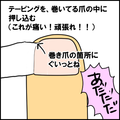 tume10