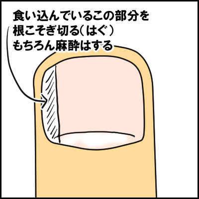 tume4