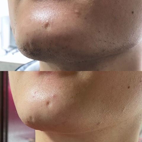 BF91AE8A-D9E0-4968-9C1F-098CF2938644