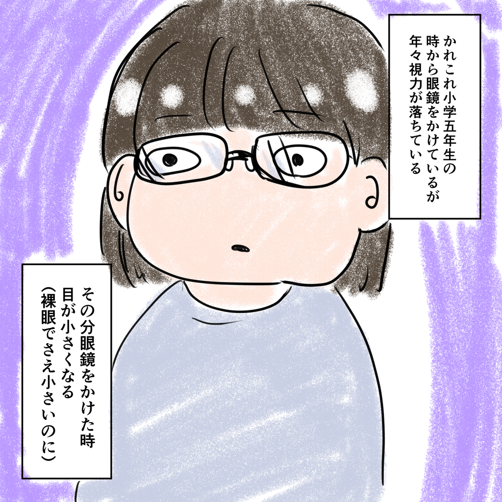 度が強くなっていく眼鏡と小さくなる目 Sun And Moon 度が強くなっていく眼鏡と小さくなる目 Sun And Moon