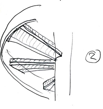 pattern-2