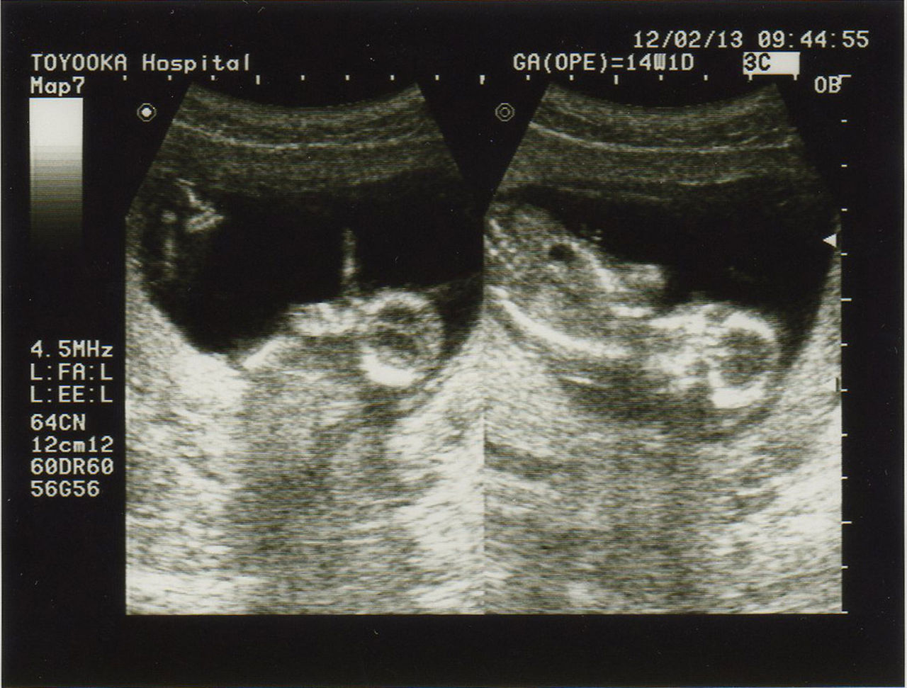 妊娠14週目 4カ月目 World Peace 栄光への軌跡 だし文化を世界へ