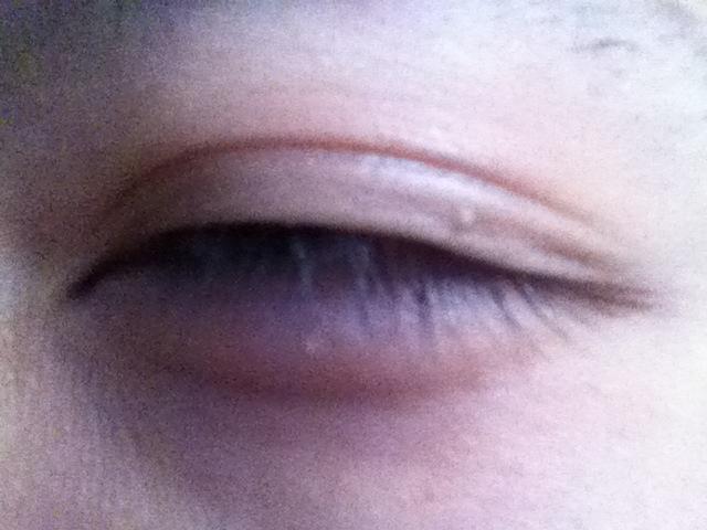 一重まぶたから二重に自力でしたけど質問ある ラジック