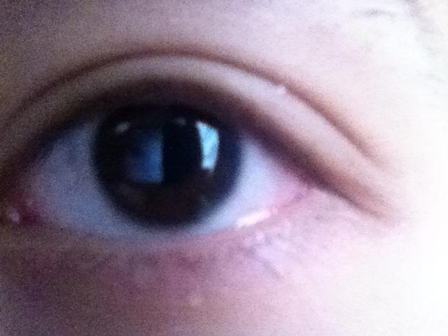 一重まぶたから二重に自力でしたけど質問ある ラジック