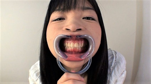 開口器でバケモノ面
