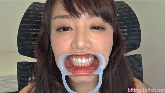 開口器を付けた浜崎真緒
