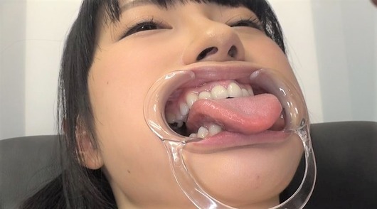開口器でベロ出し