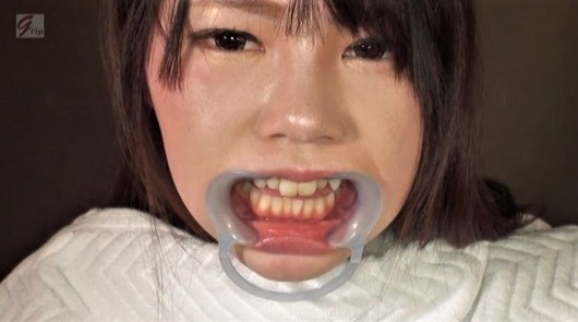 美少女が開口器でマヌケ面