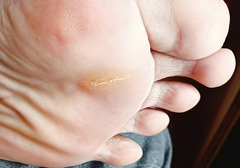 20260312AshiuraHidari