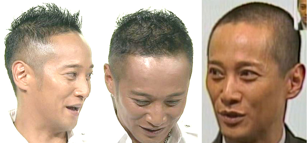 画像 薄毛でもごまかせる髪型 ルックス速報