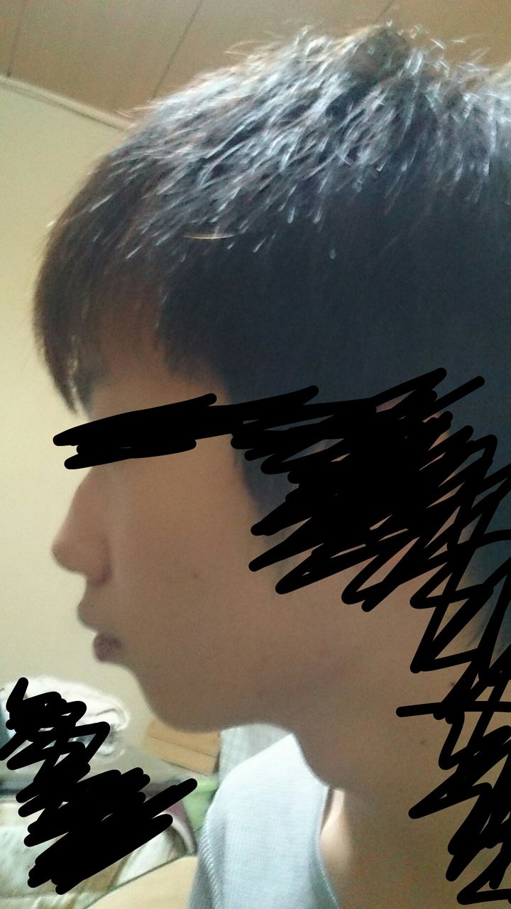 悲報 ワイ 完全にアデノイド顔で泣く ルックス速報