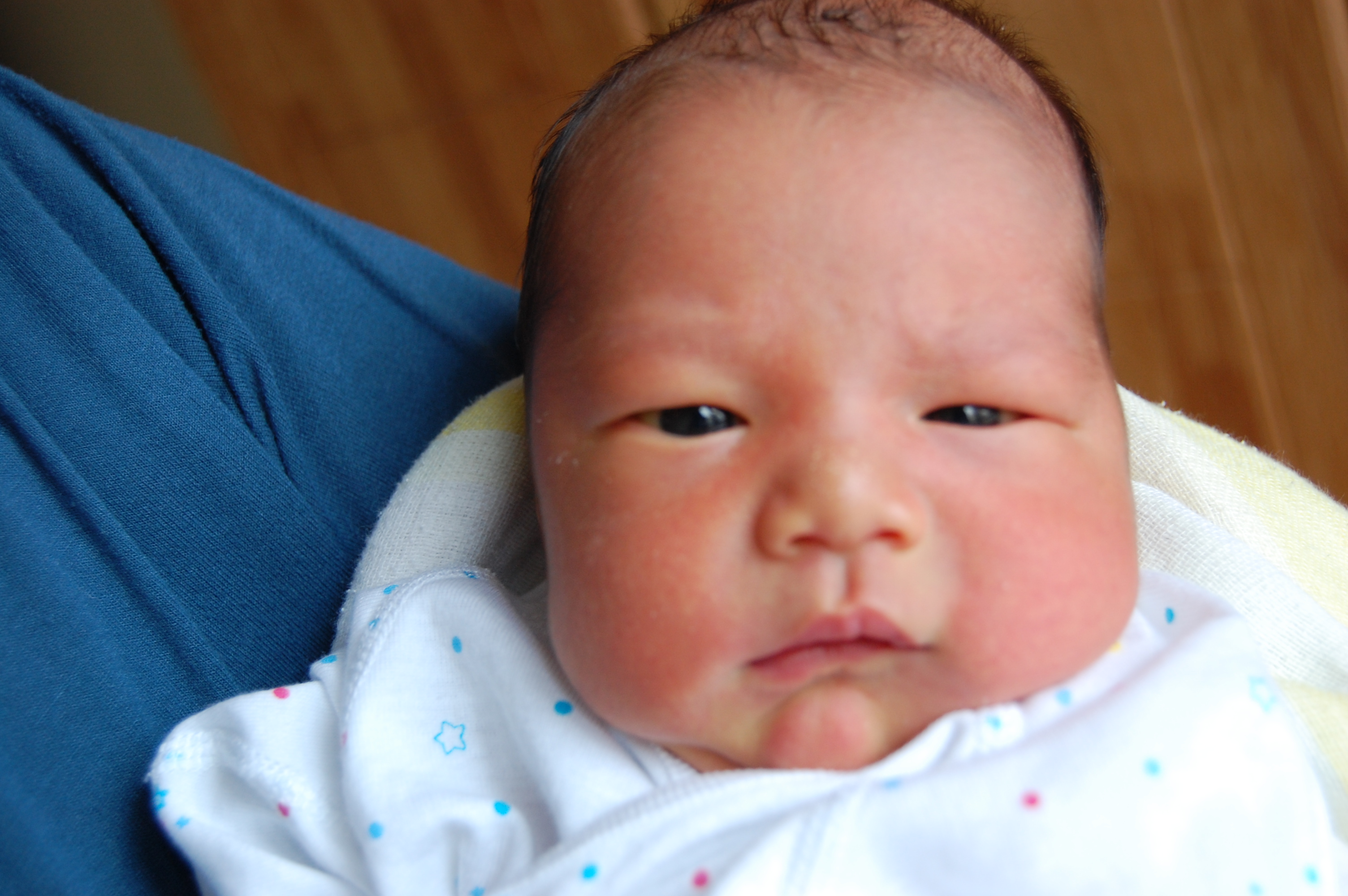 黄疸と乳腺炎 太平橋日記 ヨコハマ出戻り編