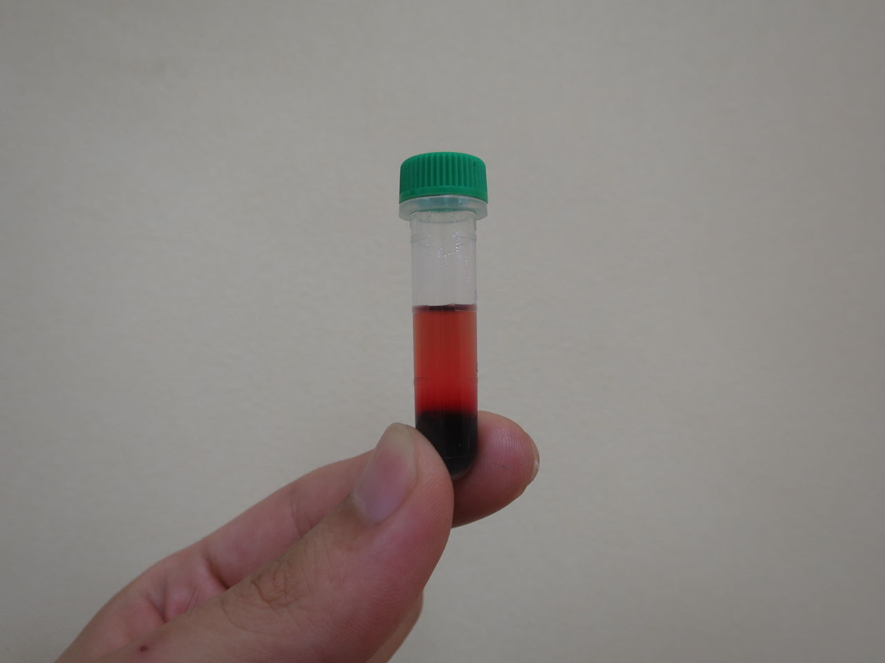 強溶血とは, 溶血とは 医療 , 溶血による生化学検査への影響と溶血度判定値の設定 – KRCTV