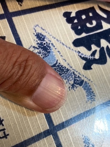 親指の爪 : 林良一ブログ RYO'S METHOD