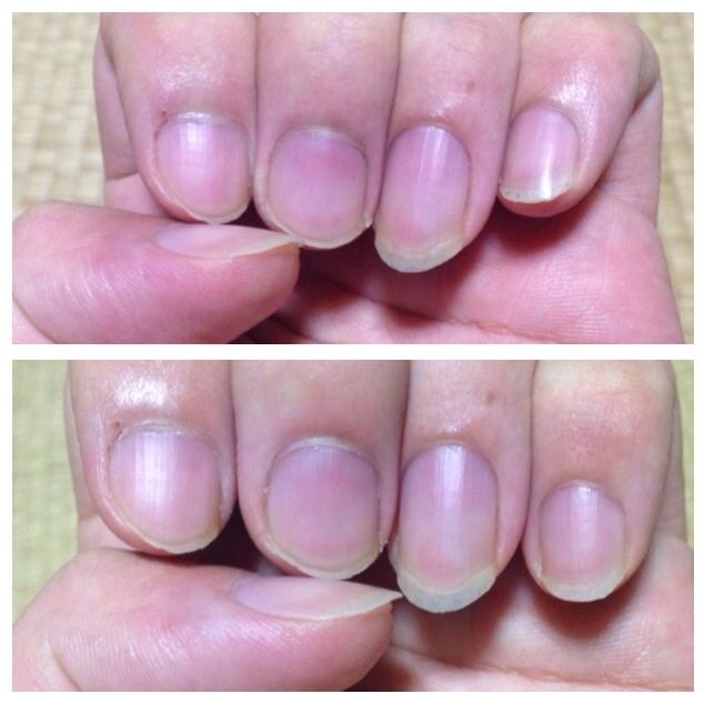 30代無職のレディースファッション 10 ネイル1 甘皮処理 ケロなまポータルu