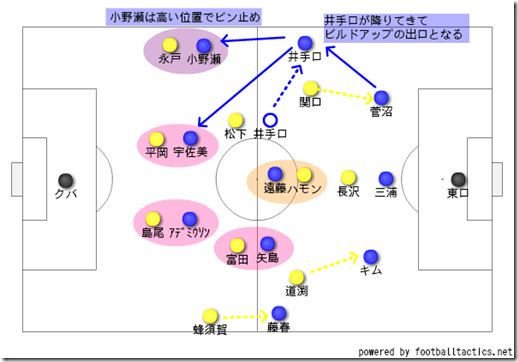 前プレス外し 前プレス外し