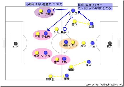 前プレス外し