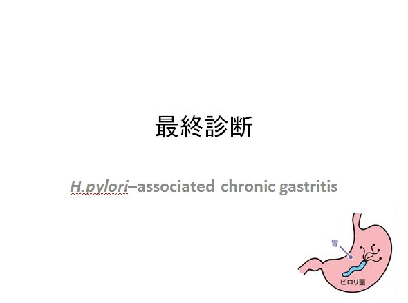 5 9 勉強会 33歳女性 心窩部痛と吐血 Ryu Sceo 琉球大学 医学部pbl勉強会