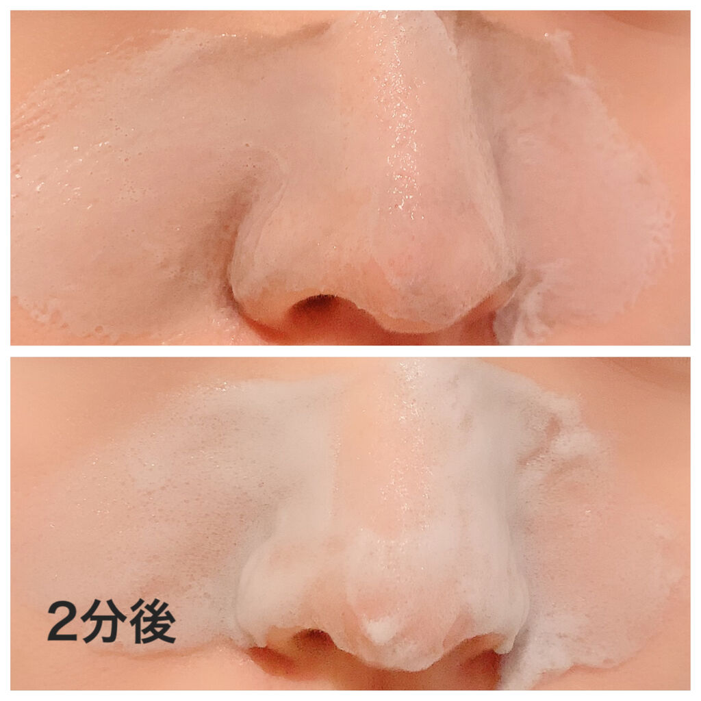 Nakuna Re 重曹黒パック Sachiのコスメブログ