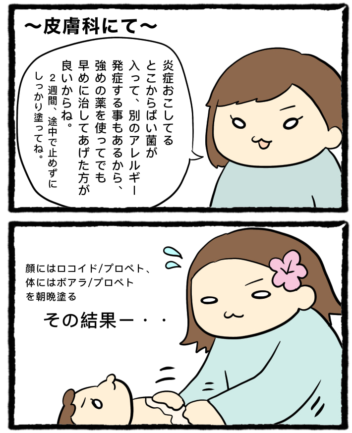 乳児湿疹 その 今日も小梅日和 梅の子育て絵日記 Powered By ライブドアブログ 乳児湿疹 その 今日も小梅日和 梅の子育て絵日記 Powered By ライブドアブログ