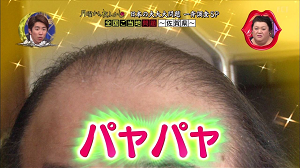 2goto27