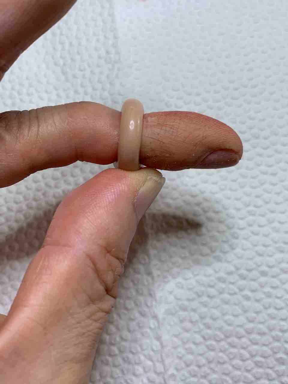 義指、エピテーゼ指