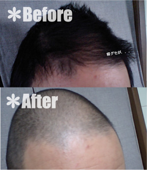 バリカン ぷ 太郎生活