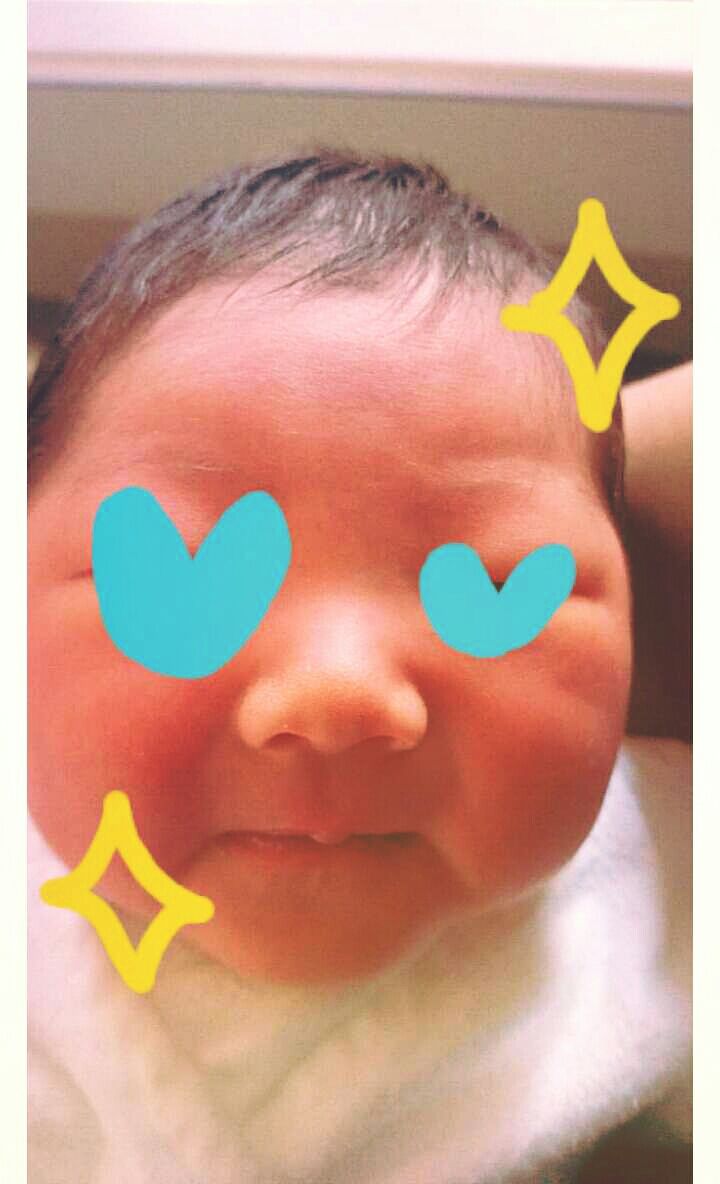 産後6日 先天性眼瞼下垂 不安 Sakuraのダメ人間ママ日誌