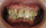 f008