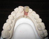 f004